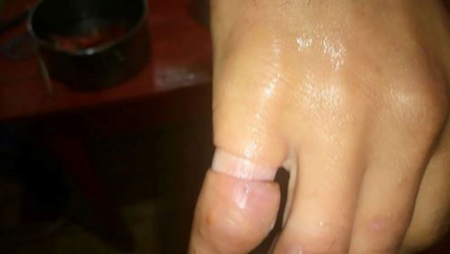 anillo dedo