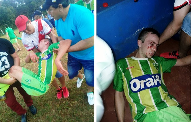 La 11ª fecha de la LROF con enfrentamientos y un jugador&nbsp;hospitalizado