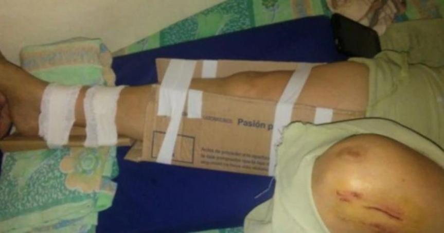 No tenían yeso en un hospital e improvisaron con&nbsp;cartón