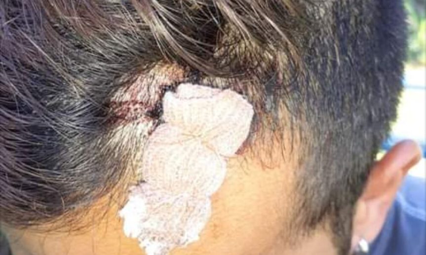 Golpearon salvajemente a un joven por ser&nbsp;gay